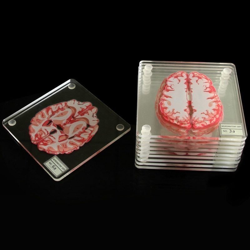Cool Anatomic Brain Specimen Novelty Placemats Coaster